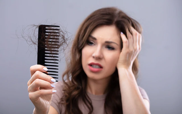 استشارية توضح أسباب تساقط الشعر الوراثي