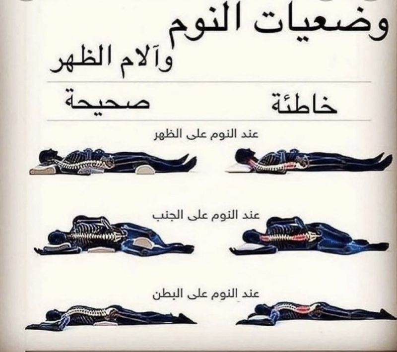 آلام الظهر