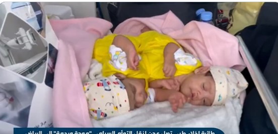 شاهد.. بدء إجراءات إخلاء التوأم اليمني مودة ورحمة