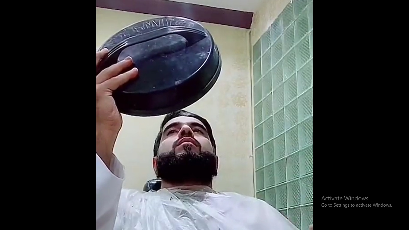 زعاق حائل حلق شنبه في بث مباشر بعد خسارته التحدي