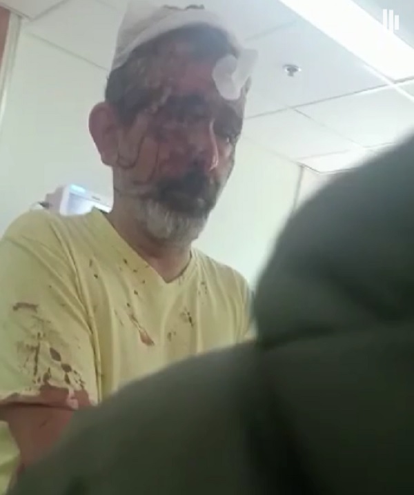 التحفظ على مصطفى هريدي بعد صدم 4 أشخاص في مصر