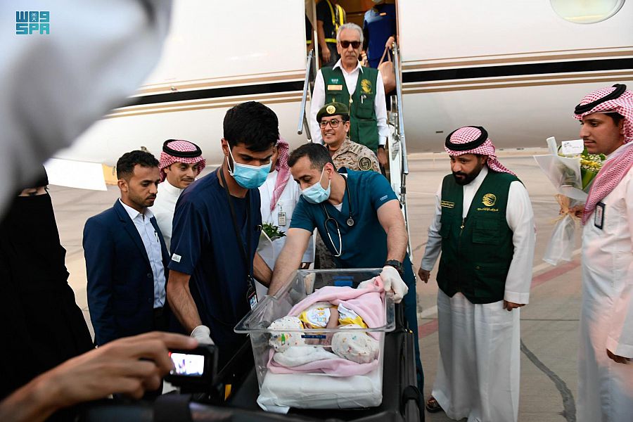 وصول التوأم السيامي اليمني مودة ورحمة إلى الرياض