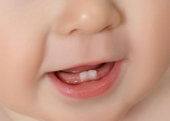 3 حالات تستدعي الذهاب للطبيب عند ظهور الأسنان اللبنية - المواطن