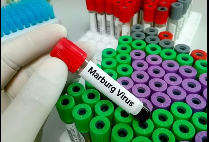 مخاوف من اندلاع جديد لـ فيروس ماربورغ أودى بحياة 90% من مرضى إفريقيا