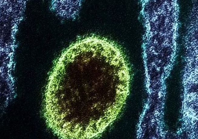 لاني فيروس جديد يظهر في الصين ويصيب 35 شخصًا