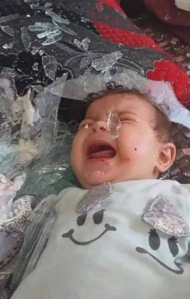 بينهم 15 طفلاً.. ارتفاع ضحايا قصف غزة لـ 44 قتيلاً و360 جريحاً