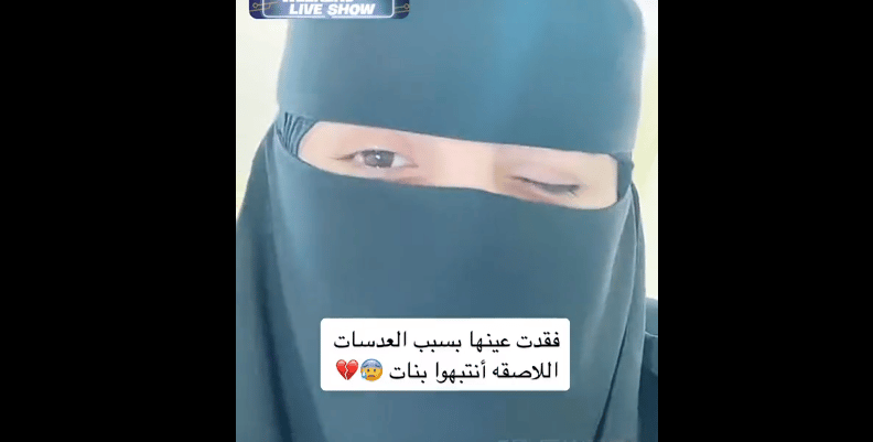 فتاة تحذر: فقدت عيني بسبب نومي بـ العدسات