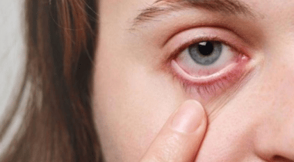 5 علامات في العين تنذر بأمراض خطيرة