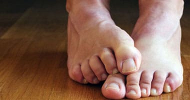 رجل يصاب بجلطة بسبب المشي حافيًا بالمنزل
