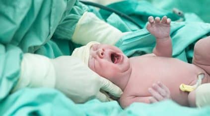 ولادة نادرة لثلاثة توائم في نجران