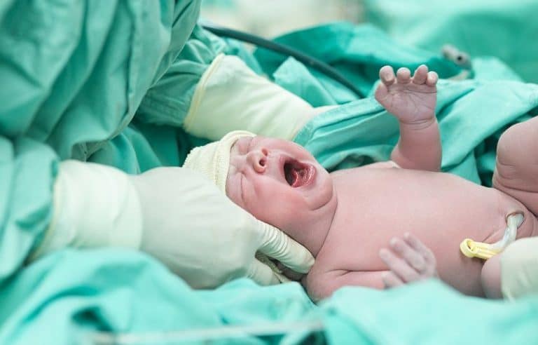 ولادة نادرة لثلاثة توائم في نجران