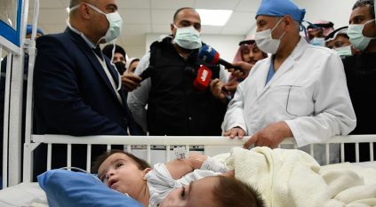 اكتمال نجاح عملية فصل التوأم السيامي العراقي بشكل نهائي
