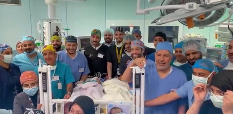 نجاحات طبية متواصلة بعد فصل التوأم السيامي اليمني وصور تذكارية للفريق