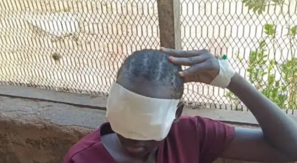 شرطي يعاقب ابنته باقتلاع عينيها في السودان