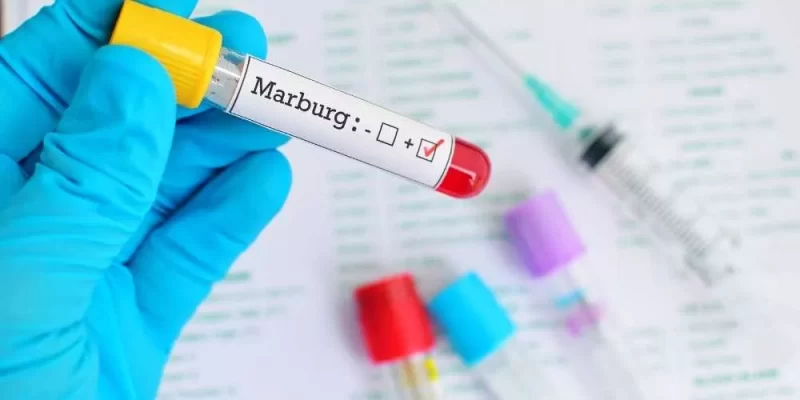 فيروس ماربورغ يفتشى في إفريقيا وأمريكا ترسل فريق مساعدة