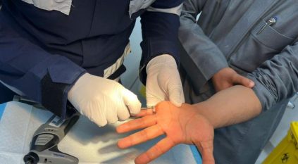 الدفاع المدني يحرر يد شخص علقت في قطعة معدنية بضرماء