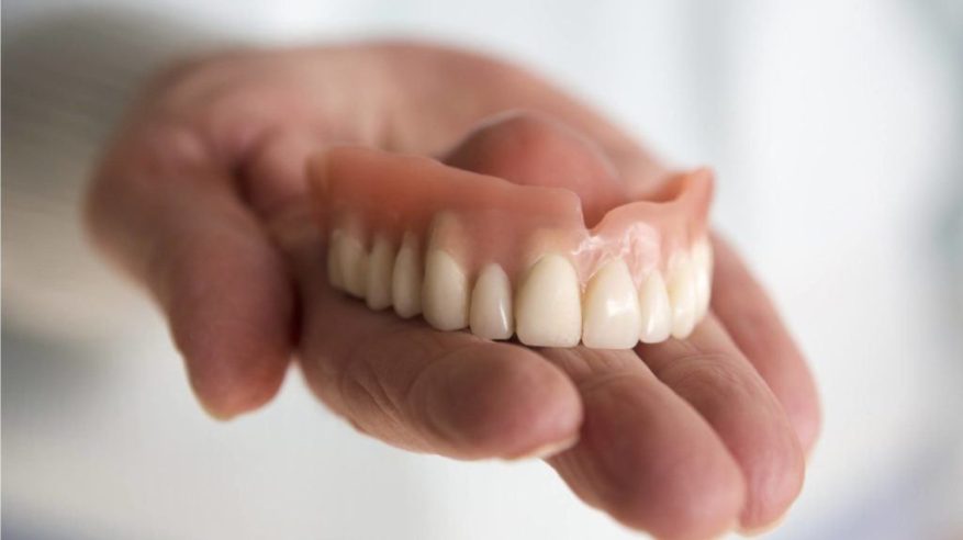 استخراج طقم أسنان من معدة شخص بعد 6 سنوات