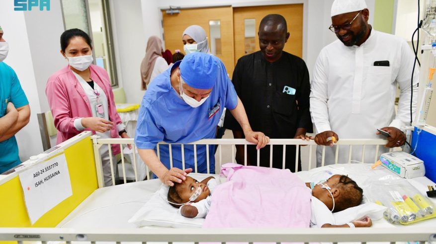 فرحة على وجه أسرتهما.. نجاح فصل التوأم النيجيري حسنة وحسينة