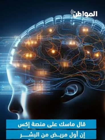 اكتشاف مؤشر بيولوجي لتسارع شيخوخة الدماغ