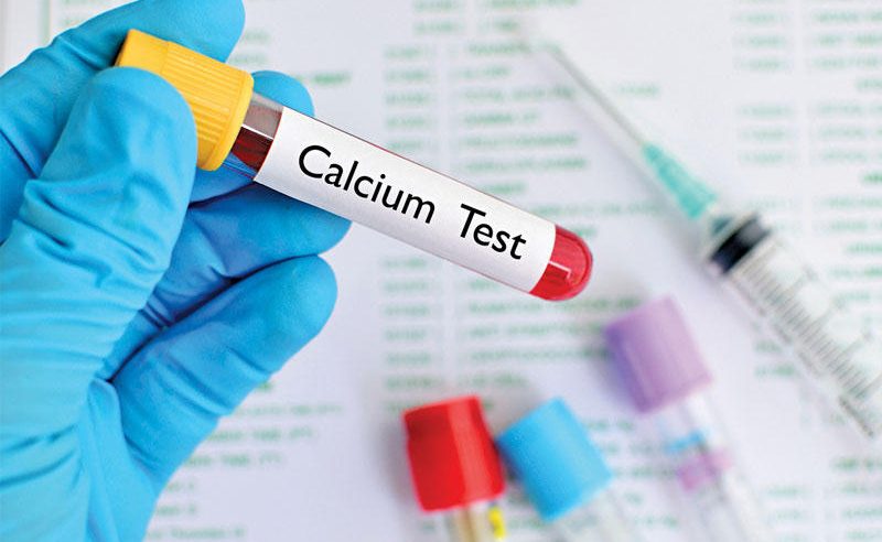 7 أسباب لنقص الكالسيوم في الدم