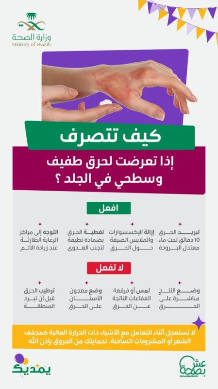 الحروق السطحية