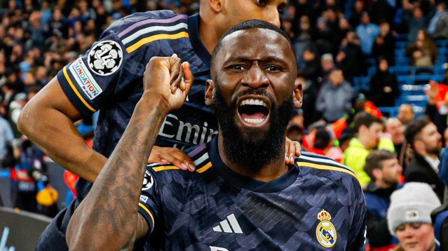 نجم ريال مدريد مهدد بإجراء عملية جراحية