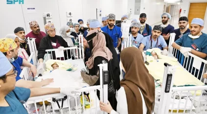 بعد جراحة الـ 15 ساعة.. نجاح فصل التوأم الملتصق الإريتري أسماء وسمية