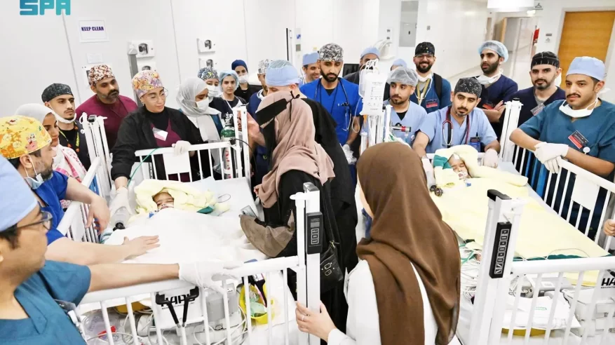 بعد جراحة الـ 15 ساعة.. نجاح فصل التوأم الملتصق الإريتري أسماء وسمية
