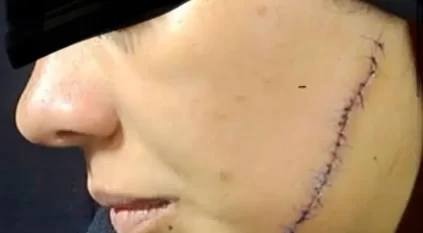 ضبط سيدة شوهت وجه عروس طليقها في مصر