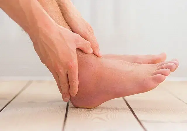أعراض تصاحب تورّم الكاحل تنذر بمخاطر صحية