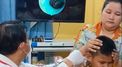 فيديو.. طفل يعاني من حكة في أذنه وعندما ذهب للطبيب كانت الصدمة