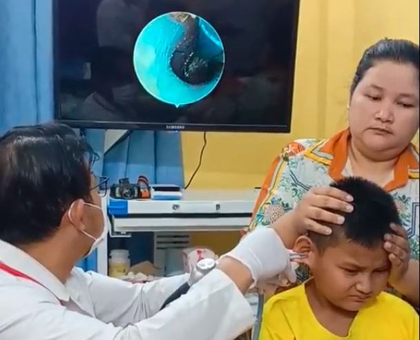 فيديو.. طفل يعاني من حكة في أذنه وعندما ذهب للطبيب كانت الصدمة