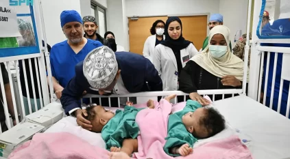 بدء عملية فصل التوأم الملتصق الصومالي رحمة ورملا في الرياض
