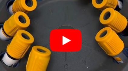 الفحوصات الدورية في رمضان.. أهمية تتضاعف مع اختلاف نمط الأكل