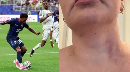 اتهام قائد فريق الرأس الأخضر باغتصاب مترجمة المنتخب