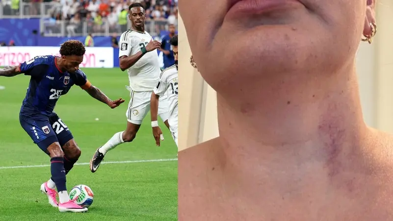 اتهام قائد فريق الرأس الأخضر باغتصاب مترجمة المنتخب