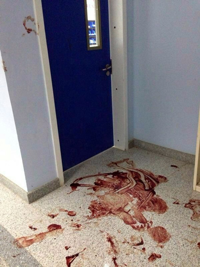 صحة نجران: حراسات مستشفى يدمة موجودون عند وقوع “الطعن وإطلاق النار”