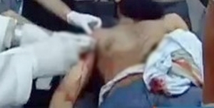 قتيل وخمسة جرحى من الشرطة في فض اعتصام رابعة