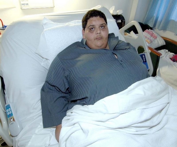 نجاح عملية جراحية لعشريني يعاني السمنة المفرطة بمدينة الملك فهد