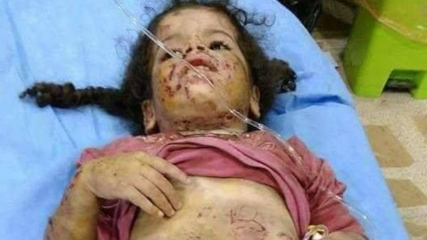 صور مروعة.. أب عراقي ينهش جسد طفلته