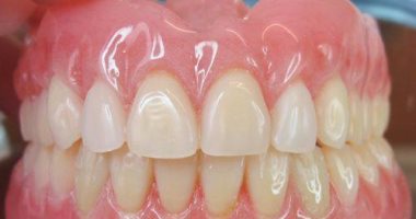 جراح فرنسي: زرع الأسنان لا يحتاج عملية جراحية