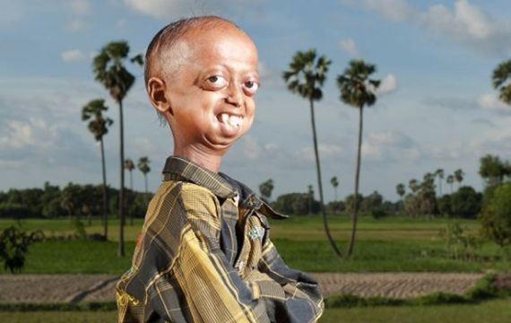 بالصور.. مراهق هندي يبلغ من العمر 110 أعوام