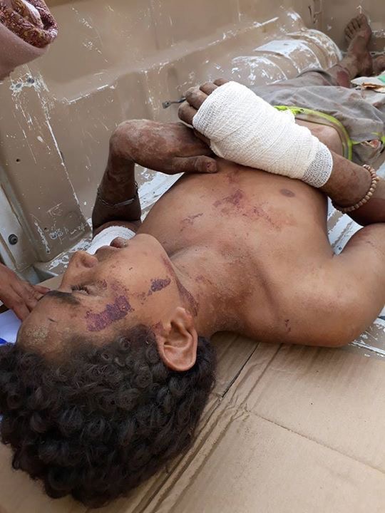 الجيش اليمني يأسر ويقتل عناصر حوثية ويصد هجومًا جنوب شرق ميدي