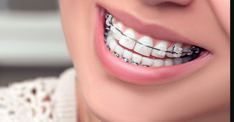 الهيزعي: العمر والجنس وصحة الأنسجة الفموية من أهم الاعتبارات قبل تقويم الأسنان