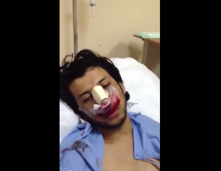 بالفيديو.. مواطن ينقذ نفسه من الموت ويعالج خطأً طبياً بنفسه!!