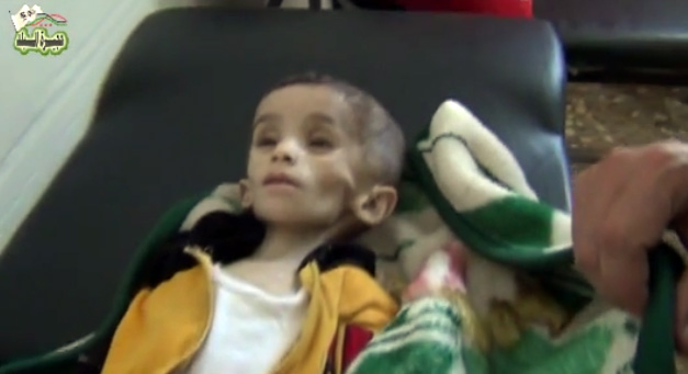 وفاة طفل سوري بسبب الحصار وقلة المواد الغذائية