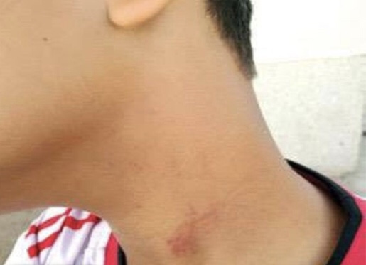 التعليم تحقق في اعتداء معلم على طالب بالمدينة المنورة