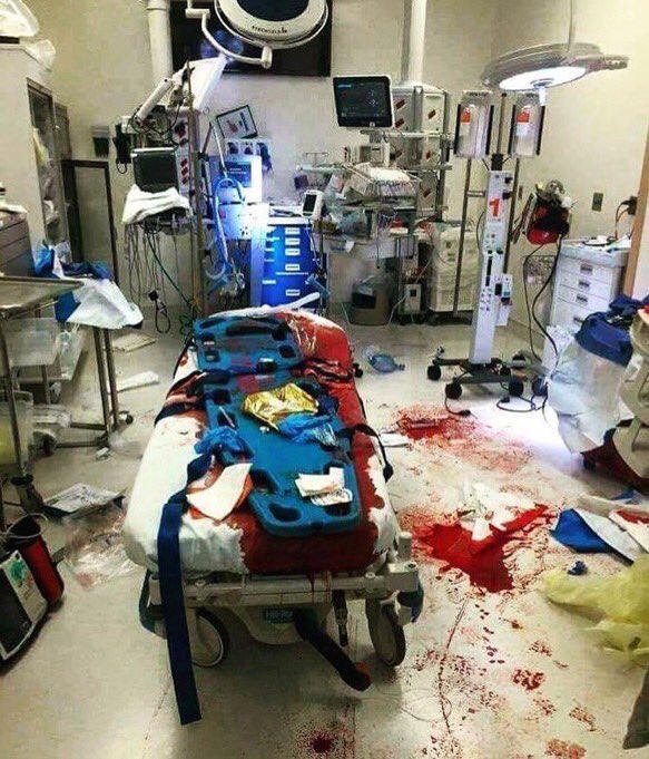 طبيب ينشر صورة ملطخة بالدماء من داخل غرفة العمليات والسبب