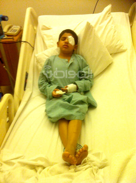 مستشفى الملك خالد للعيون يستخرج رصاصة من رأس طفل