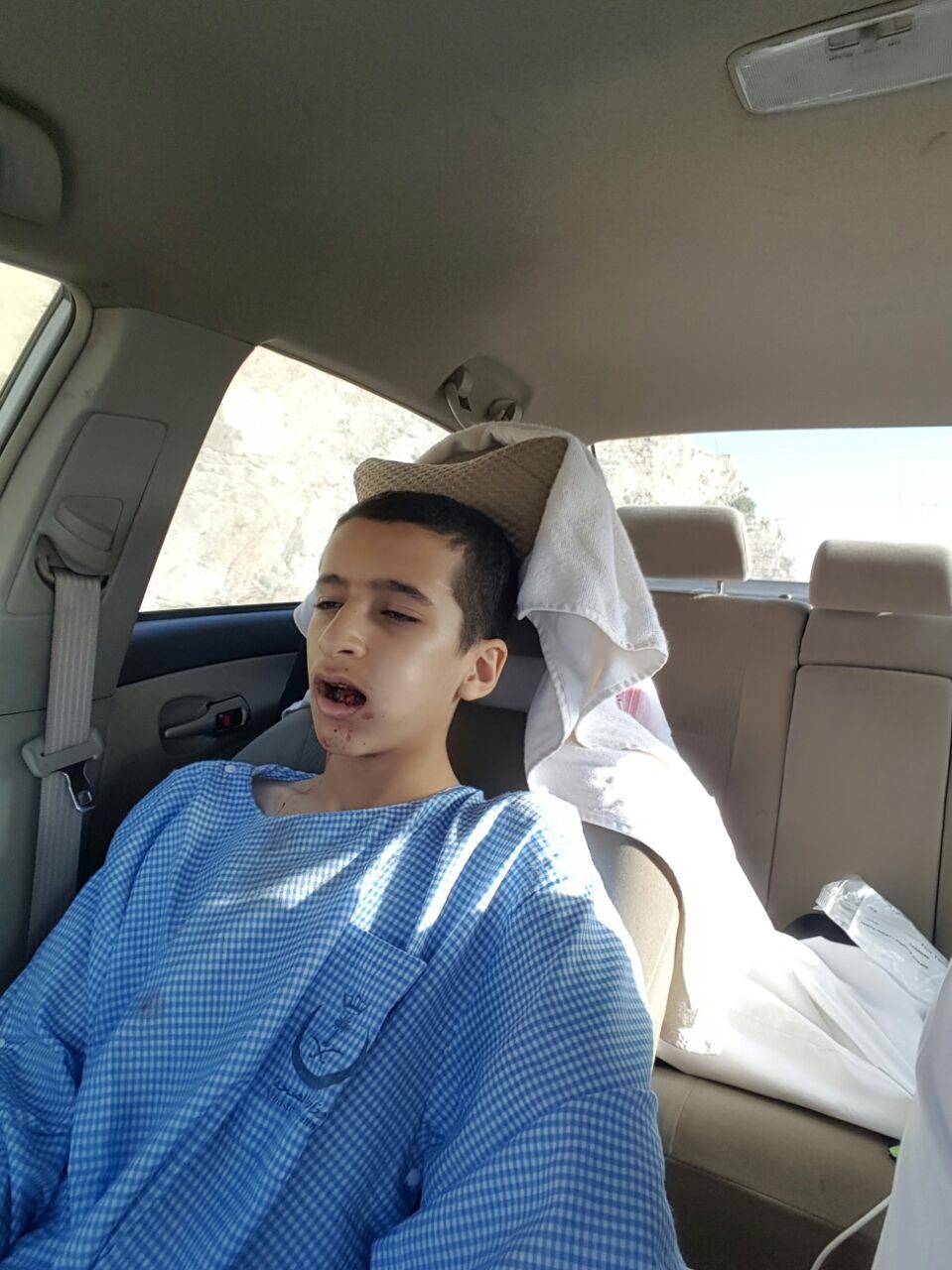 #عاجل بالصور.. “المواطن” تكشف قصة شاب دخل في غيبوبة بعد خلع ضرسه بالنماص